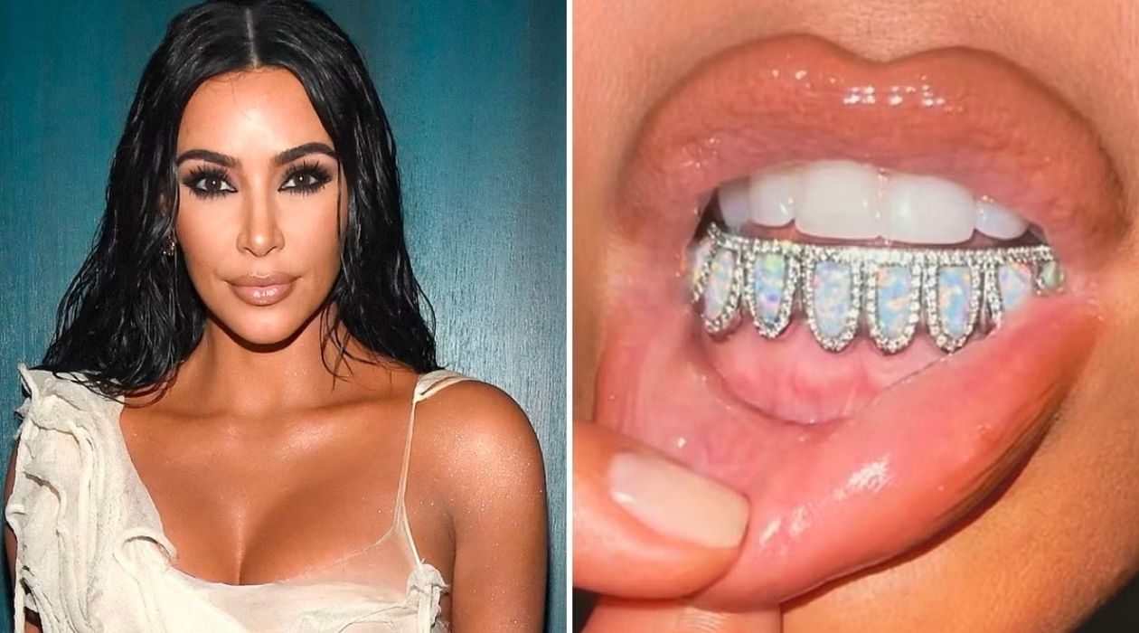 Secret Behind Kim Kardashian's White Teeth (1)